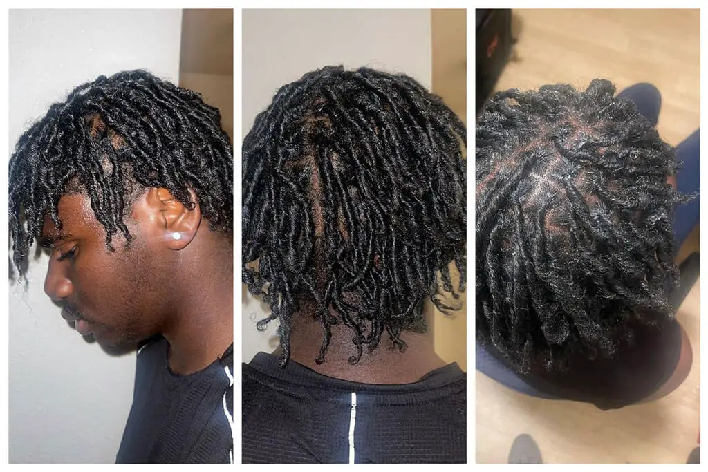 starter stage  of dreadlokcs : 3-6 months